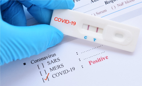 В АПЛ обновлен антирекорд по положительным тестам на COVID-19 - более 100 за последнюю неделю